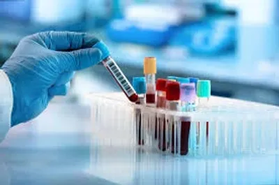 معمل تحاليل للبيع في القاهره الجديده التجمع الخامس قسط 